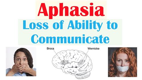 aphkhihe|Aphakia: Definition, Causes and Treatment .